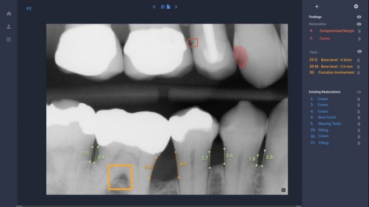 Overjet sinks its teeth into another round of capital for its dental AI tech
